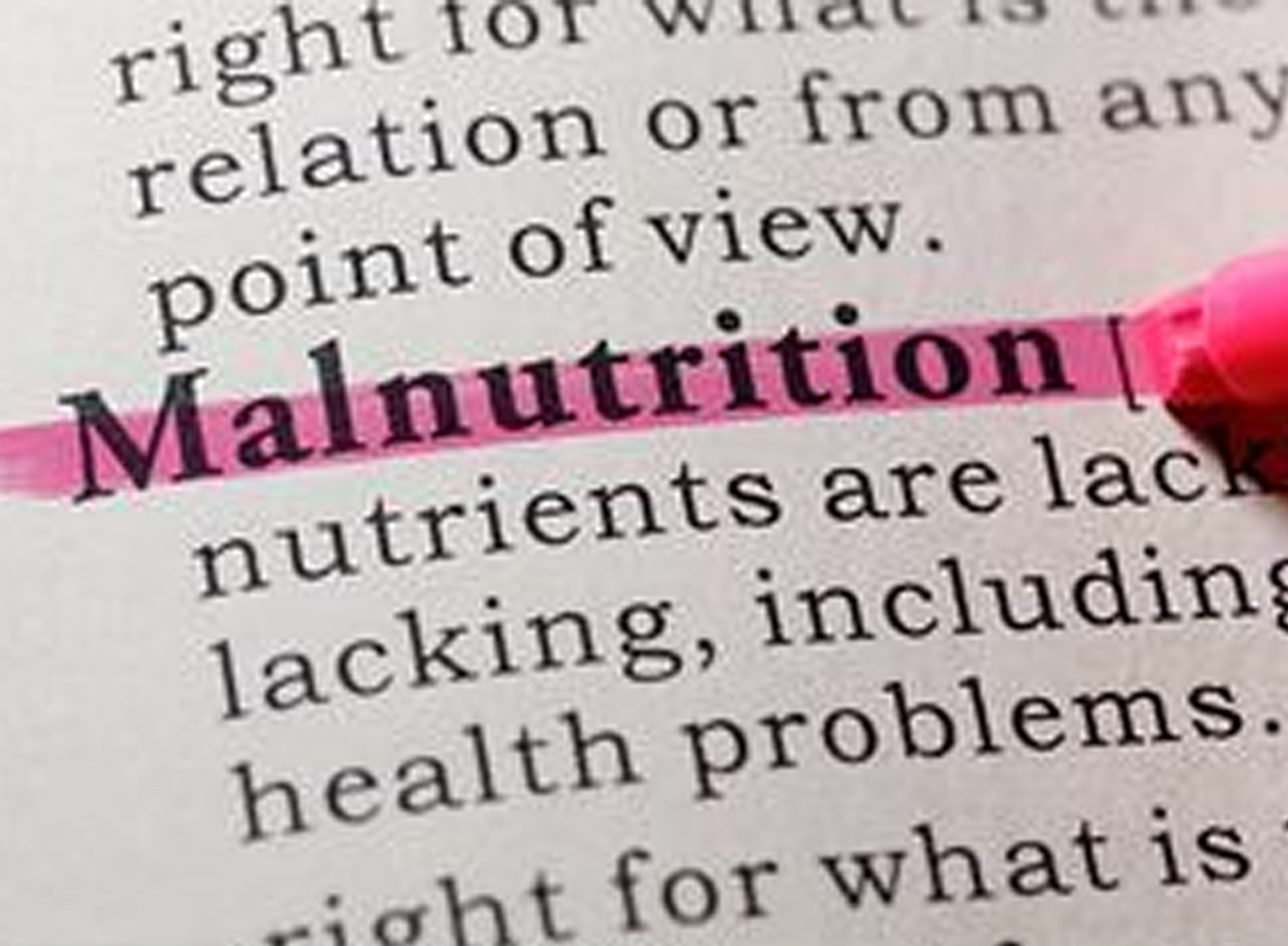 Namibia faces malnutrition headache