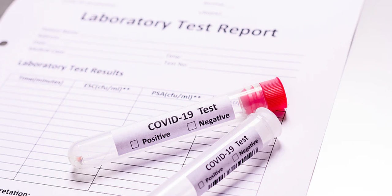 Learner tests positive for COVID-19