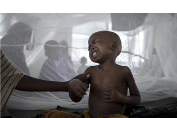 MoHSS investigate suspected cholera outbreak in Opuwo