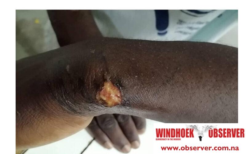 Military Police accused of brutally beating a boy in Rundu